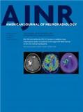 AMERICAN JOURNAL OF NEURORADIOLOGY