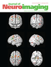 JOURNAL OF NEUROIMAGING