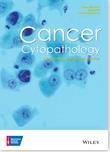 CANCER CYTOPATHOLOGY